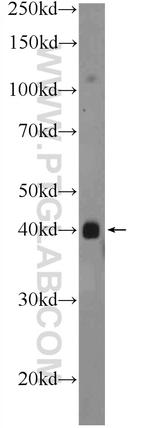 PHC2 Antibody in Western Blot (WB)