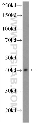 PHC2 Antibody in Western Blot (WB)