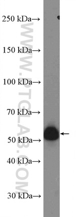 UGCG Antibody in Western Blot (WB)