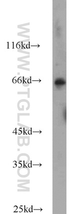 HLF Antibody in Western Blot (WB)