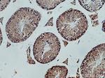 PPEF1 Antibody in Immunohistochemistry (Paraffin) (IHC (P))