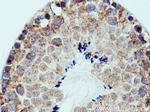 PPEF1 Antibody in Immunohistochemistry (Paraffin) (IHC (P))