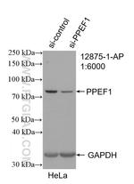 PPEF1 Antibody in Western Blot (WB)