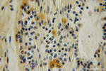 SH2D3C Antibody in Immunohistochemistry (Paraffin) (IHC (P))