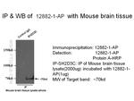 SH2D3C Antibody in Immunoprecipitation (IP)