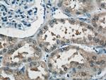 NUDT16 Antibody in Immunohistochemistry (Paraffin) (IHC (P))