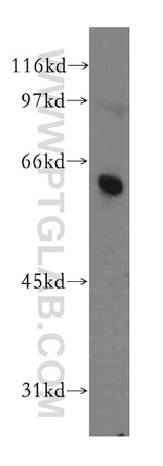 DYRK4 Antibody in Western Blot (WB)
