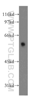 DYRK4 Antibody in Western Blot (WB)