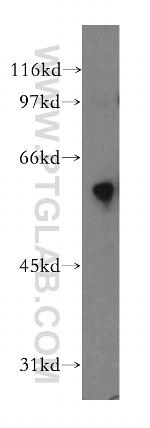 DYRK4 Antibody in Western Blot (WB)