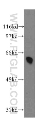 DYRK4 Antibody in Western Blot (WB)