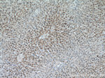 RPN1 Antibody in Immunohistochemistry (Paraffin) (IHC (P))