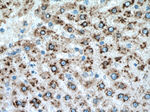 RPN1 Antibody in Immunohistochemistry (Paraffin) (IHC (P))