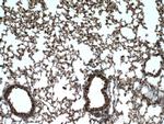 RPN1 Antibody in Immunohistochemistry (Paraffin) (IHC (P))