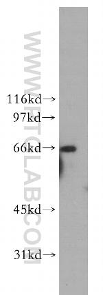 RPN1 Antibody in Western Blot (WB)