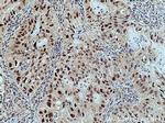 CUL1 Antibody in Immunohistochemistry (Paraffin) (IHC (P))