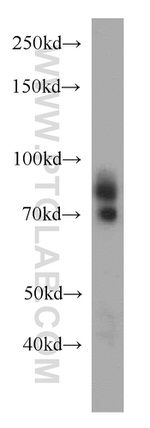 DTL Antibody in Western Blot (WB)