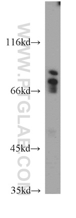 DTL Antibody in Western Blot (WB)