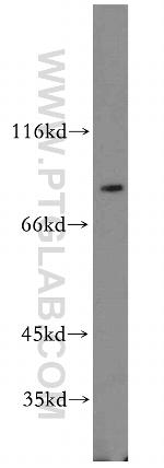 DTL Antibody in Western Blot (WB)