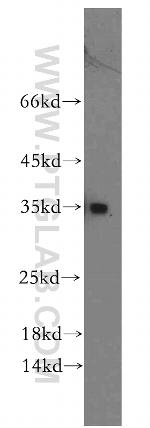 RCAN2 Antibody in Western Blot (WB)