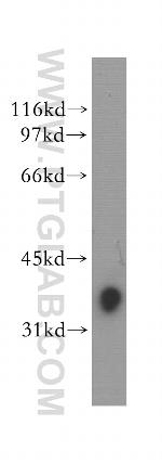 SLAMF7 Antibody in Western Blot (WB)