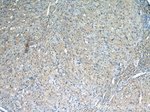 THADA Antibody in Immunohistochemistry (Paraffin) (IHC (P))