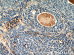 THADA Antibody in Immunohistochemistry (Paraffin) (IHC (P))