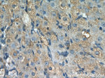 THADA Antibody in Immunohistochemistry (Paraffin) (IHC (P))