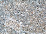 THADA Antibody in Immunohistochemistry (Paraffin) (IHC (P))