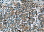 THADA Antibody in Immunohistochemistry (Paraffin) (IHC (P))