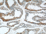 THADA Antibody in Immunohistochemistry (Paraffin) (IHC (P))