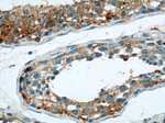 THADA Antibody in Immunohistochemistry (Paraffin) (IHC (P))