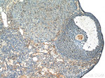 THADA Antibody in Immunohistochemistry (Paraffin) (IHC (P))