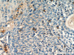 THADA Antibody in Immunohistochemistry (Paraffin) (IHC (P))
