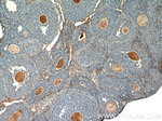 THADA Antibody in Immunohistochemistry (Paraffin) (IHC (P))