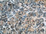 THADA Antibody in Immunohistochemistry (Paraffin) (IHC (P))