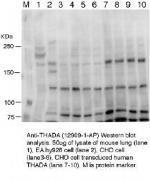THADA Antibody in Western Blot (WB)