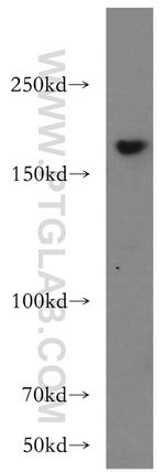 THADA Antibody in Western Blot (WB)