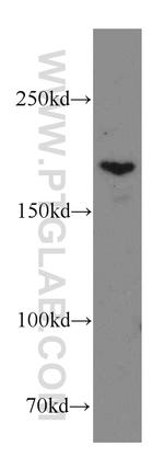 THADA Antibody in Western Blot (WB)