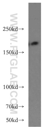 THADA Antibody in Western Blot (WB)