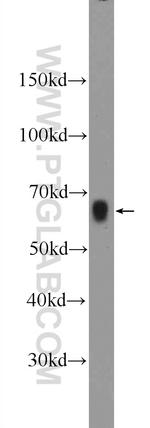 AOAH Antibody in Western Blot (WB)