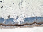TGM1 Antibody in Immunohistochemistry (Paraffin) (IHC (P))