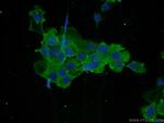PLS3 Antibody in Immunocytochemistry (ICC/IF)