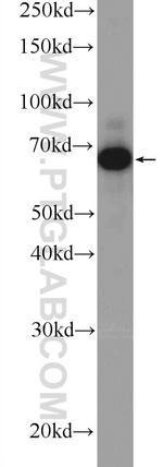 PLS3 Antibody in Western Blot (WB)