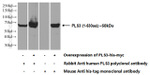 PLS3 Antibody in Western Blot (WB)