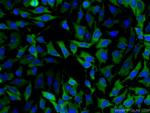 PDE4D Antibody in Immunocytochemistry (ICC/IF)