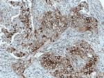 PKC Pan Antibody in Immunohistochemistry (Paraffin) (IHC (P))