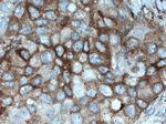 PKC Pan Antibody in Immunohistochemistry (Paraffin) (IHC (P))