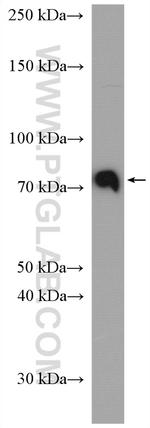 PKC Pan Antibody in Western Blot (WB)