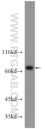 PKC Pan Antibody in Western Blot (WB)