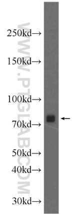 PKC Pan Antibody in Western Blot (WB)
